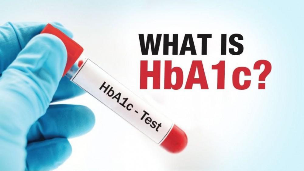 HbA1cを知っていますか？ （ 糖尿病を改善させる歯周病治療について）